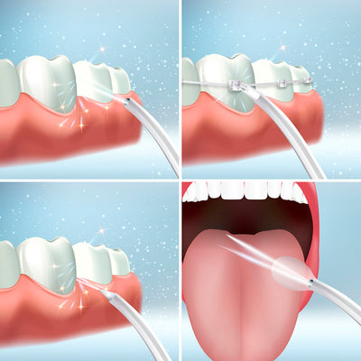 Irrigador Dental Recargable Portátil Denter InnovaGoods (Reacondicionado A)